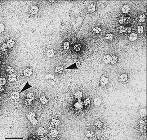 M Structure Electron Micrographs Of M Negatively Stained With