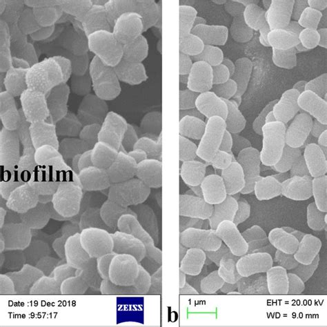 SEM Micrographs Of L Plantarum RS66CD Grown In A Modified MRS Medium