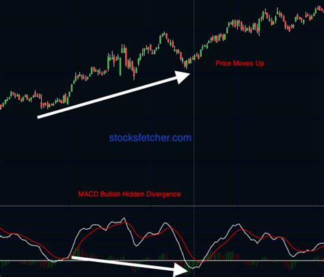 How To Use The MACD Indicator Ultimate Guide