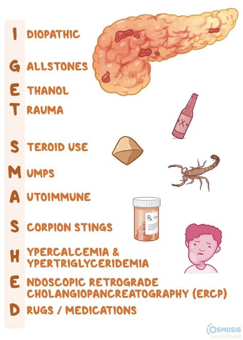 Understanding Acute Pancreatitis: Causes, Symptoms, And Treatment - Ask ...