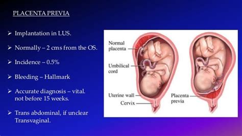 Ultrasound Imaging Of Placenta