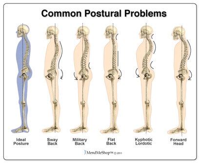 Postural Correction And Assistance With Kinesio Taping