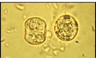 Toxoplasma Gondii New Flashcards Quizlet