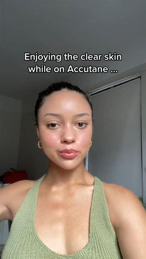 MY SIDE EFFECTS ON ACCUTANE 🥴 | Skin treatments, Acne treatments & kits ...