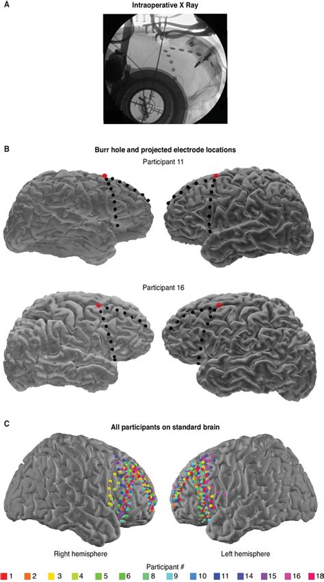 Figures And Data In Human Subthalamic Nucleus Activity During Non Motor