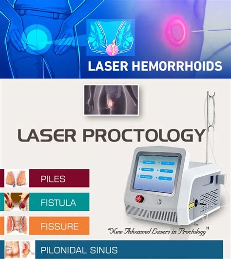 Surgical Hemorrhoid Laser Instrument Treatment Device 1470nm Anal