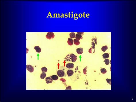 Ppt Leishmaniasis Powerpoint Presentation Free Download Id9127583