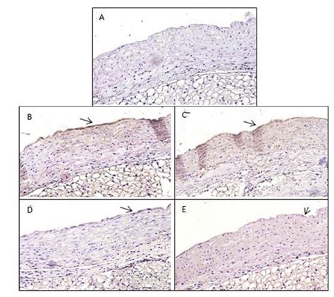 Effects Of ALA On VCAM 1 Expression On The Surface Of Vascular Walls