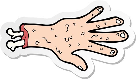 Sticker Of A Gross Severed Hand Cartoon 8716791 Vector Art At Vecteezy