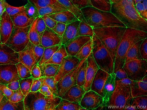 Occludin Antibody Ap Proteintech