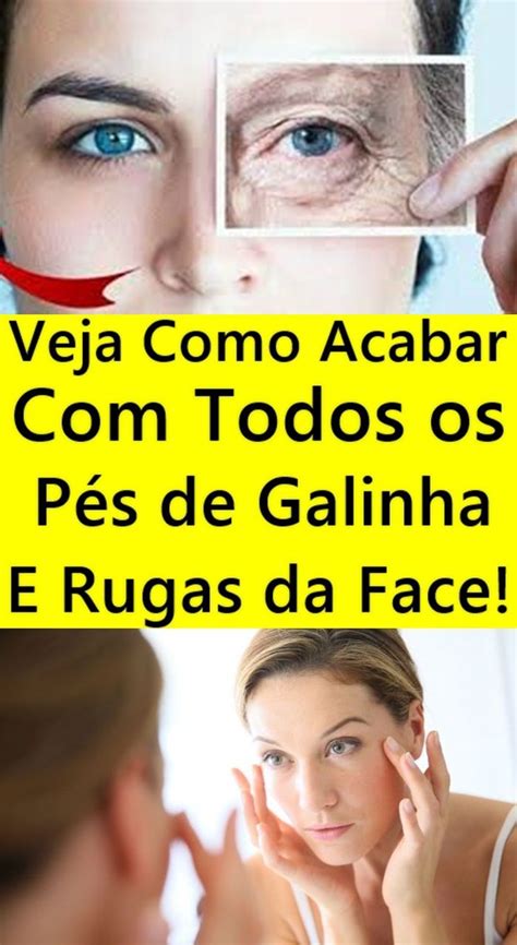 Como Eu Acabei Os P S De Galinha E Rugas Na Pele Em Semana Sem