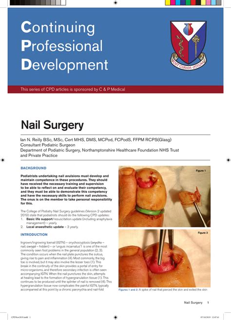 Pdf Continuing Professional Development Nail Surgery