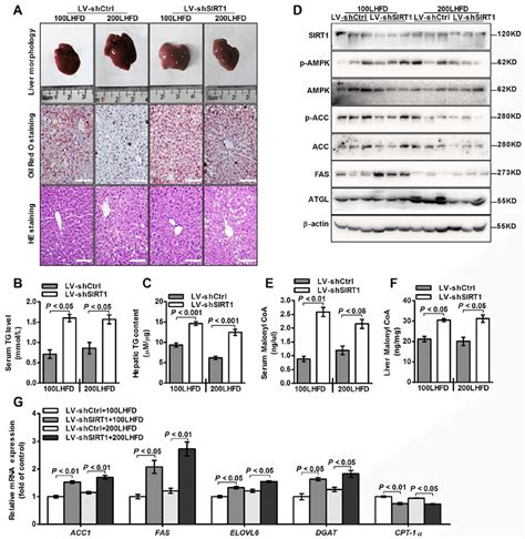 Knockdown Of Sirt1 Shrna Accelerates Hepatic Triglyceride Accumulation