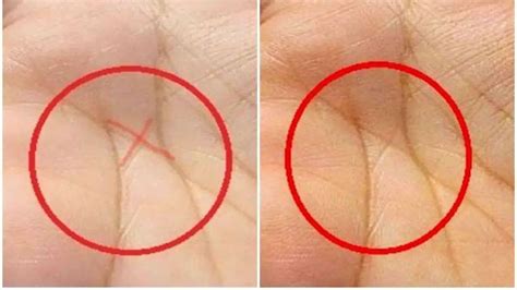 Do You Have An X Sign On Your Palm Know What Palmistry Says About It