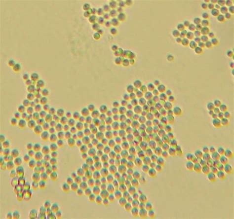 Fun With Microbiology (What's Buggin' You?): Cryptococcus neoformans