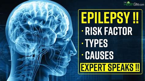 National Epilepsy Day Know The Risk Factors Types Causes Of