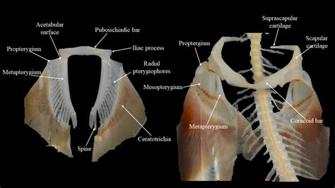 Squalus skeleton | Atlas of Comparative Vertebrate Anatomy