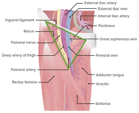 Femoral Hernia Anatomy Of Femoral Hernia The Best Porn Website