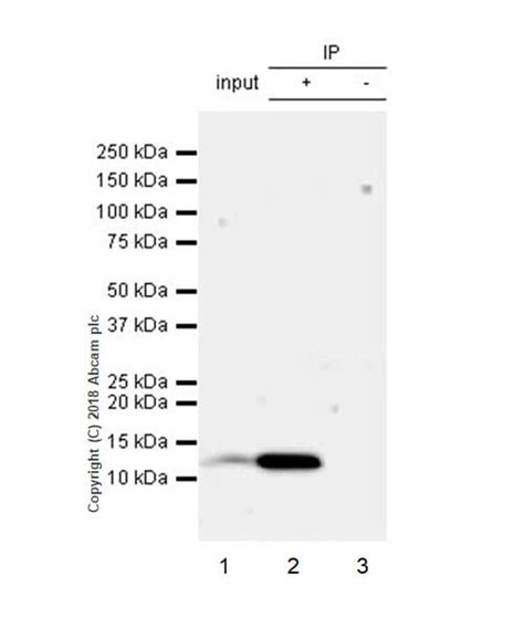 Anti Beta 2 Microglobulin 抗体 Epr21752 214 Ab218230