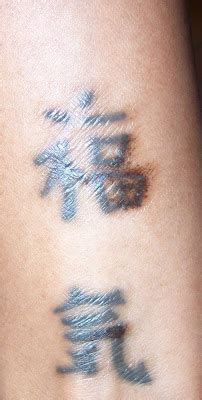 I Am...LondonDiva: Tattoo Removal With TCA [Chemical Peel]