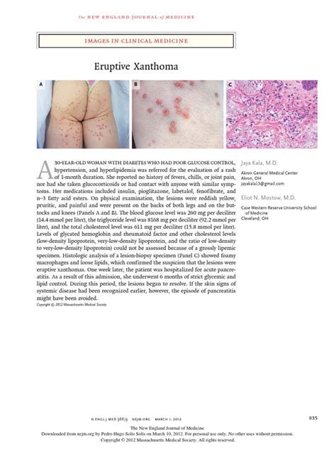 Eruptive Xanthoma Images In Clinical Medicine Download Free Pdf Diseases And Disorders