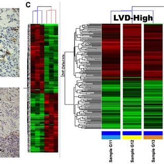 Identification Of A Gene Expression Signature To Classify Different