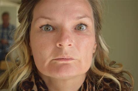 Hi Babe Prp Facial At 300 Dates Monday 22nd Wednesday 24th Or Saturday 20th What Works For You