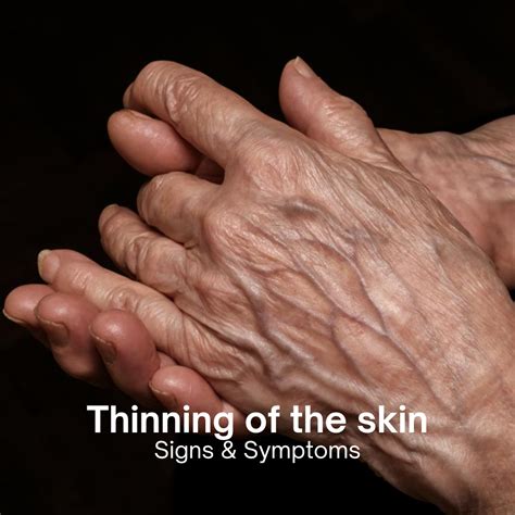 Thinning Of The Skin Causes Symptoms And Treatment