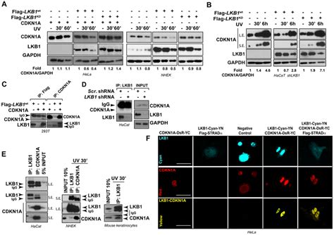 LKB1 Binds CDKN1A A LKB1 Kinase Activity Is Necessary To Induce