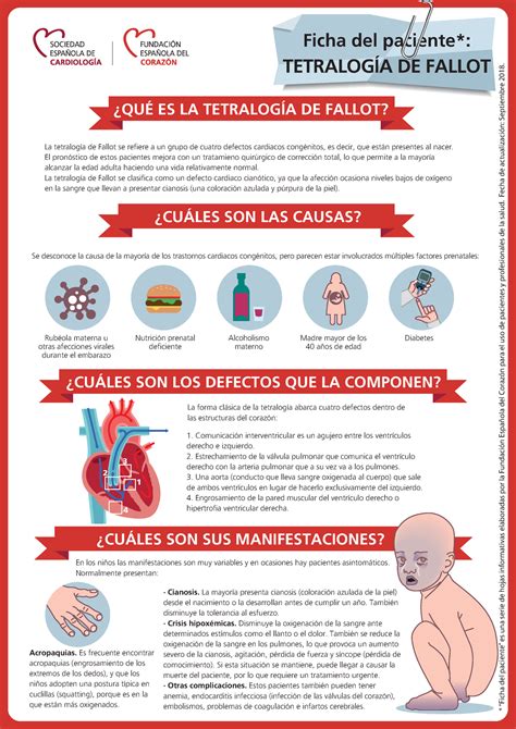 Tetralogia de Fallot Ficha del paciente TETRALOGÍA DE FALLOT Se