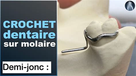 Apprenez Fa Onner Un Crochet Demi Jonc Sur Molaire Avec La Pince