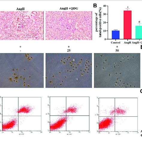 Qdg Attenuates Ang Ii Induced Renal Cell Apoptosis In Vivo And In