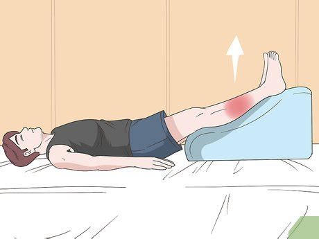 Easy Ways to Cover Cellulitis: 8 Steps (with Pictures) - wikiHow Health