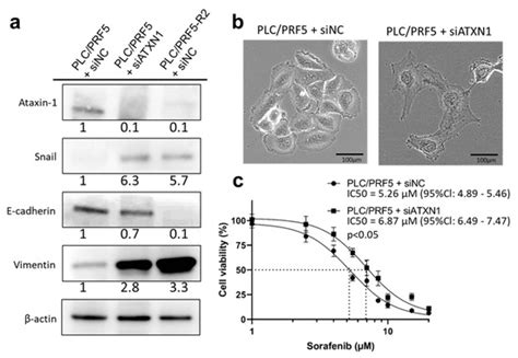 Cancers Free Full Text Mir 125b 5p Is Involved In Sorafenib Resistance Through Ataxin 1