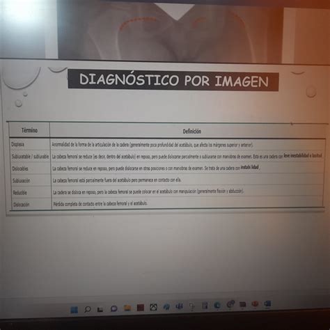 Fichas De Aprendizaje Tema Displasia Cong Nita De Cadera Quizlet