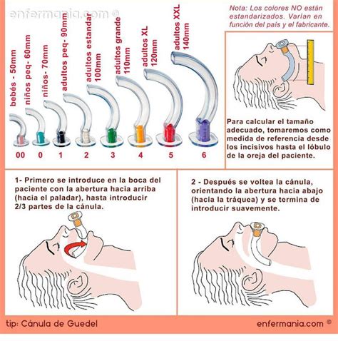 Ems Solutions International Marca Registrada Intubacion Endotraqueal