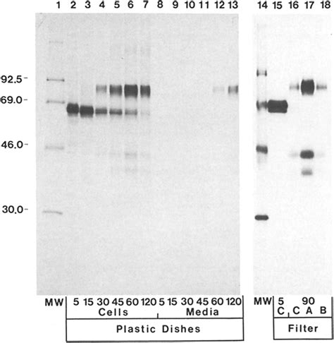 Pulse Chase Analysis Of The Processing And Secretion Of Gp In The