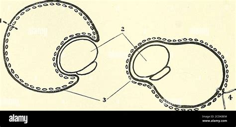 Surgery Its Principles And Practice Fig 327 —tapping A Hydrocele