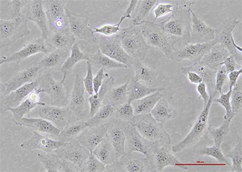 人卵巢癌细胞 Skov3（str鉴定正确） 细胞系 细胞库 旗赛生物科技（武汉）有限公司