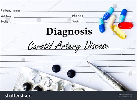 Carotid Artery Disease Diagnosis Written On Stock Photo 669312736 ...