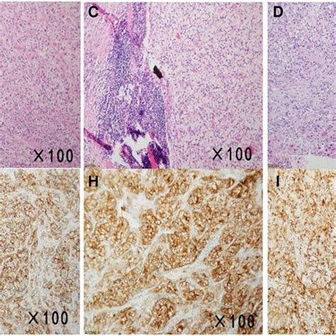 Micrographs Of The Surgical Specimens And Immunohistochemical Download Scientific Diagram