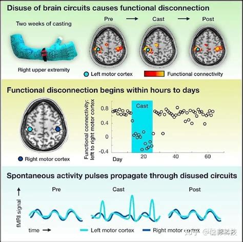 Neuron：人脑废用神经环路中的可塑性与自发活动脉冲 知乎