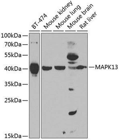 Anti Mapk13 抗体 Cab7496 Assay Genie