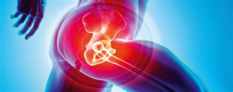 Can Hip Labrum Tears Be Treated Without Surgery Connected Health