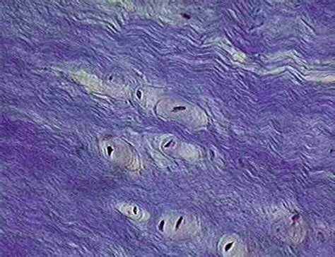 Fibrocartilage Connective Tissue