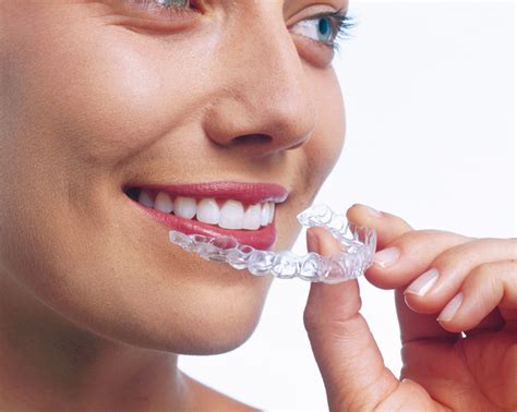 Soins Orthodontie Appareil Dentaire Et Aligneurs Invisible