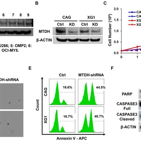 Decreased Mtdh Expression Induces Mm Cell Growth Inhibition In Vitro