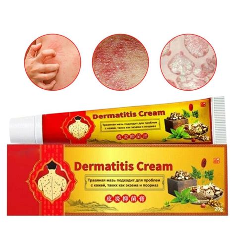 Pc G Effective Psoriasis Eczema Tinea Rash Cream Anti Itching