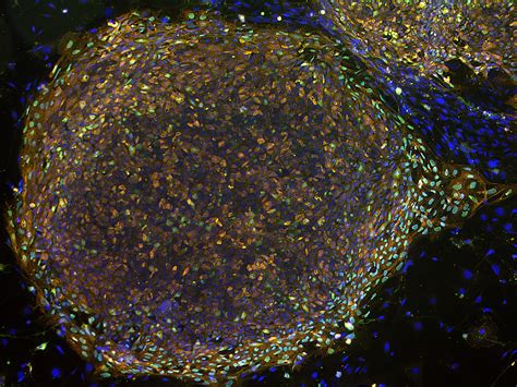 A Multicolored Colony Of Stem Cells Cera