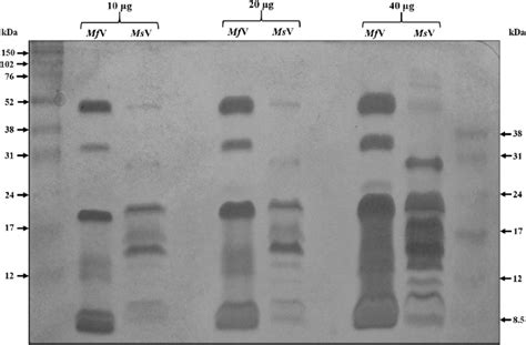 Sds Polyacrylamide Gel Electrophoresis Of Micrurus Venoms Samples 10